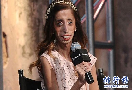 世界上最醜的女人：利茲·維拉斯奎茲