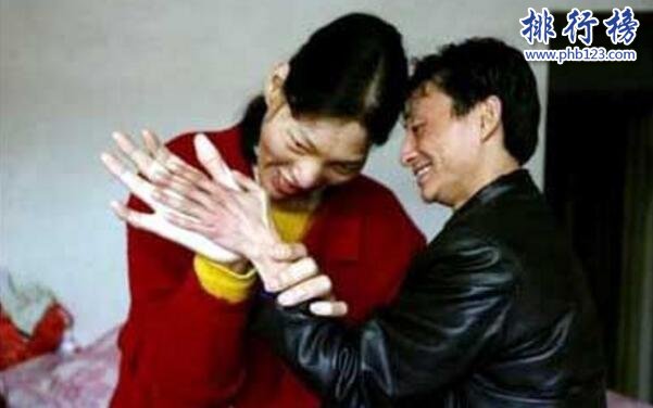 中國最高的女人是誰,姚德芬身高2.4米(腳長45.5厘米)