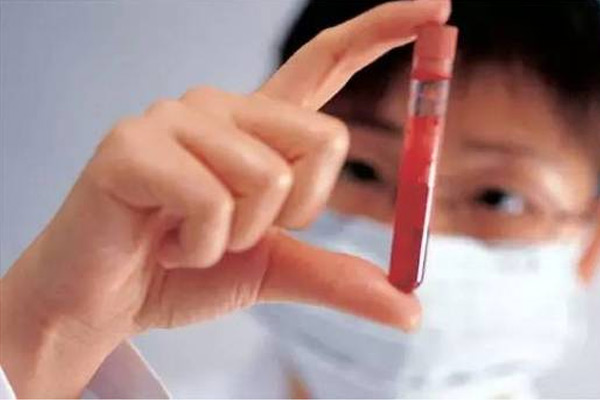 世界上最稀有的血型排名 KELL血型