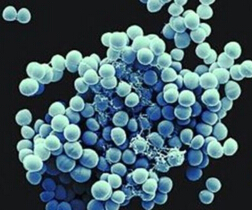 金黃色葡萄球菌是什麼?人體化膿感染的病原菌（嚴重可引起肺炎）