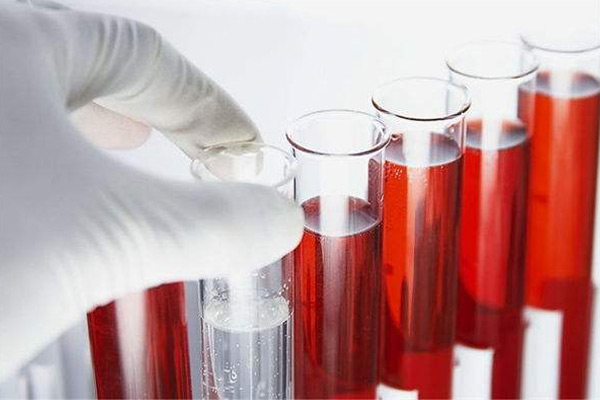 世界上最稀有的血型排名 LEWIS血型