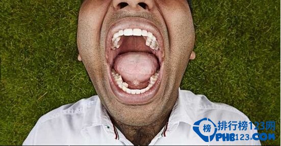 世界上有最多牙齒的人 牙齒多達三十多顆