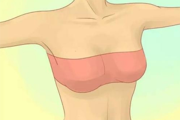胸部下垂外擴怎么辦