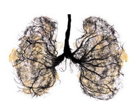 五大肺癌早期前兆,殺死萌芽時期的癌症